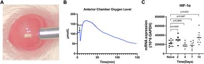 Therapeutic potential of topical administration of acriflavine against hypoxia-inducible factors for corneal fibrosis